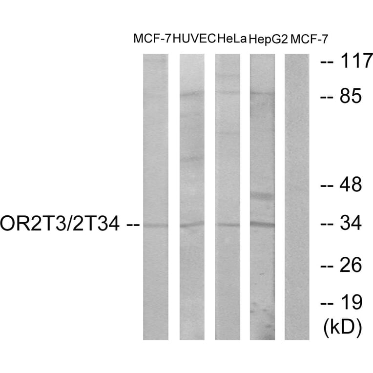Western Blot - Anti-OR2T3 + OR2T34 Antibody (G568) - Antibodies.com