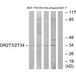 Western Blot - Anti-OR2T3 + OR2T34 Antibody (G568) - Antibodies.com