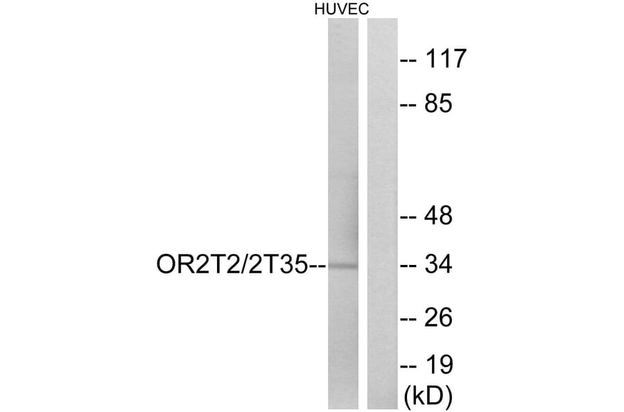 Western Blot - Anti-OR2T2 + OR2T35 Antibody (G439) - Antibodies.com