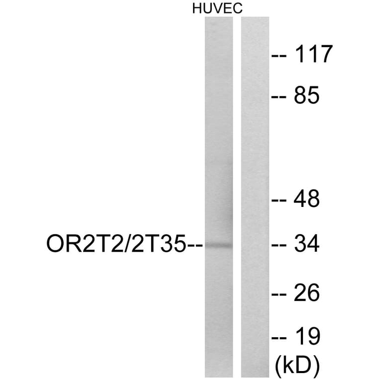 Western Blot - Anti-OR2T2 + OR2T35 Antibody (G439) - Antibodies.com