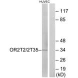 Western Blot - Anti-OR2T2 + OR2T35 Antibody (G439) - Antibodies.com