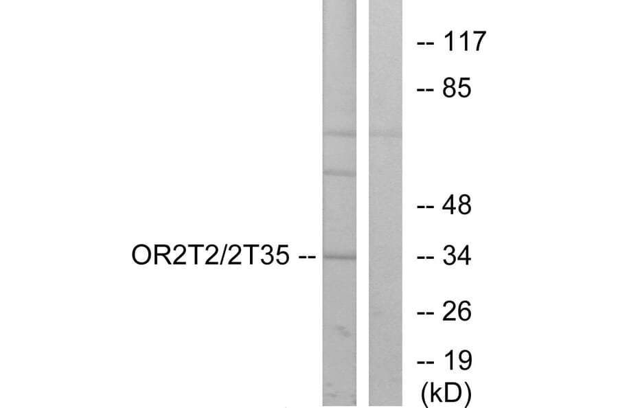 Western Blot - Anti-OR2T2 + OR2T35 Antibody (G566) - Antibodies.com