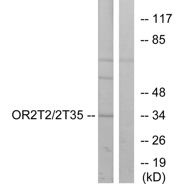 Western Blot - Anti-OR2T2 + OR2T35 Antibody (G566) - Antibodies.com