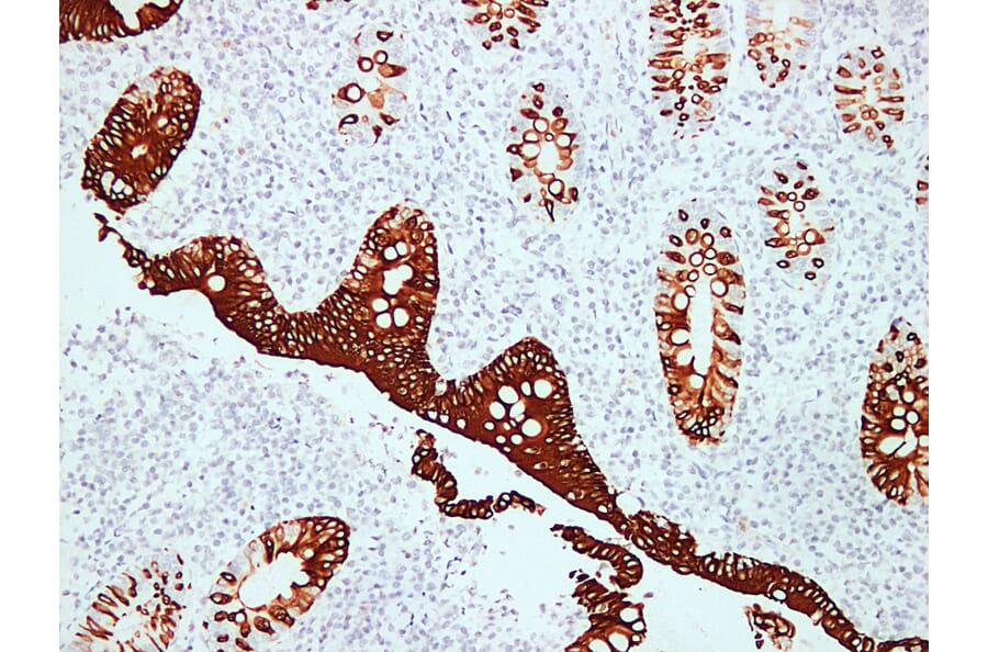 Immunohistochemistry - Anti-Cytokeratin 20 Antibody (V0052) - Antibodies.com