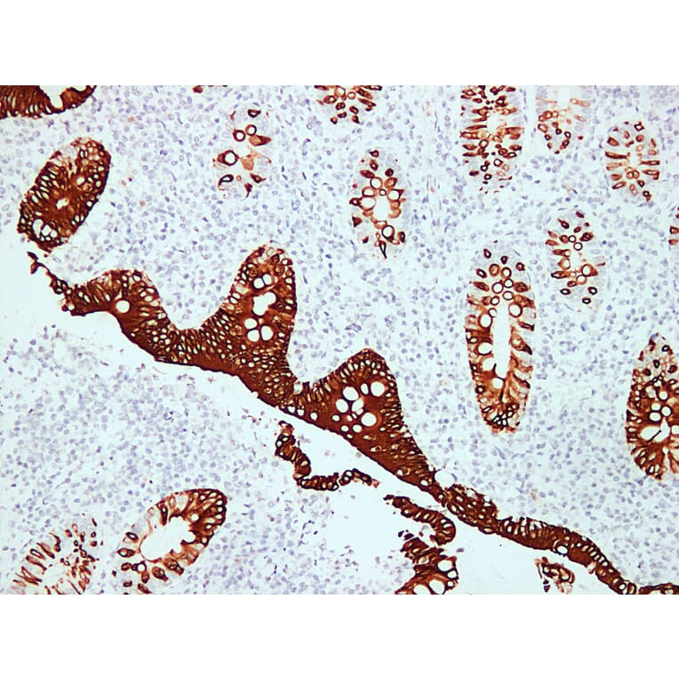 Immunohistochemistry - Anti-Cytokeratin 20 Antibody (V0052) - Antibodies.com