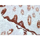 Immunohistochemistry - Anti-Cytokeratin 20 Antibody (V0052) - Antibodies.com