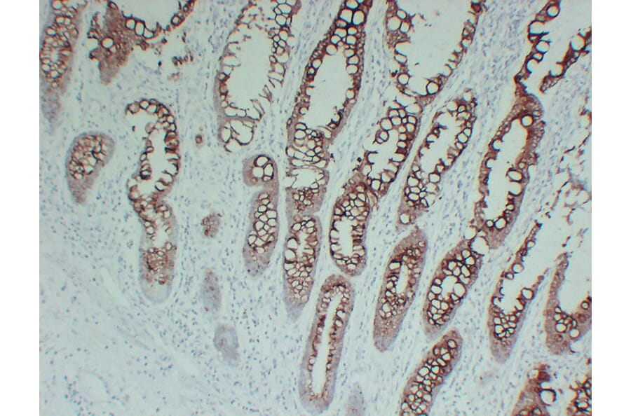 Immunohistochemistry - Anti-Cytokeratin 20 Antibody (V0052) - Antibodies.com