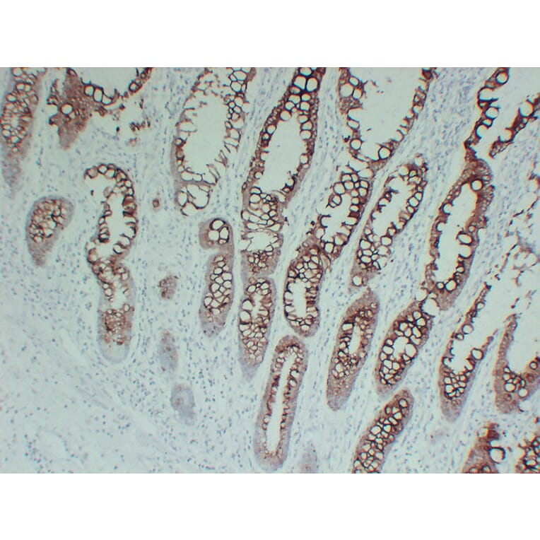 Immunohistochemistry - Anti-Cytokeratin 20 Antibody (V0052) - Antibodies.com
