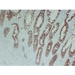 Immunohistochemistry - Anti-Cytokeratin 20 Antibody (V0052) - Antibodies.com