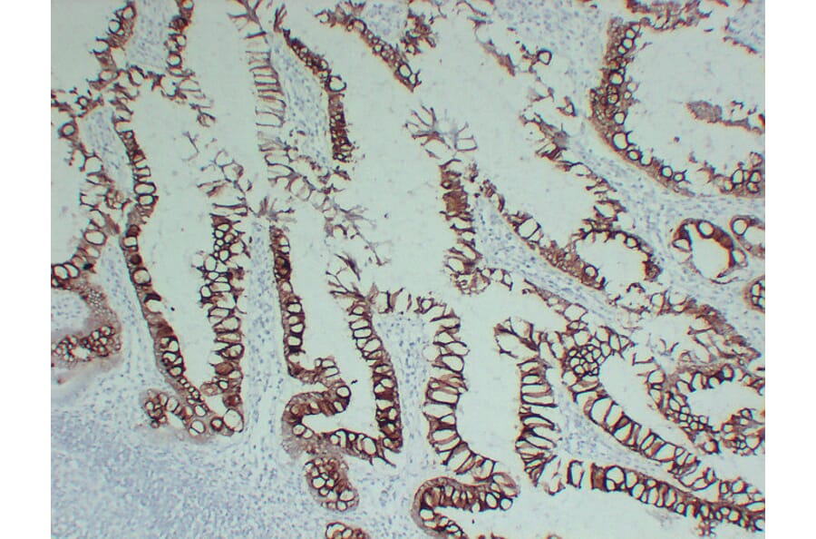 Immunohistochemistry - Anti-Cytokeratin 20 Antibody (V0052) - Antibodies.com