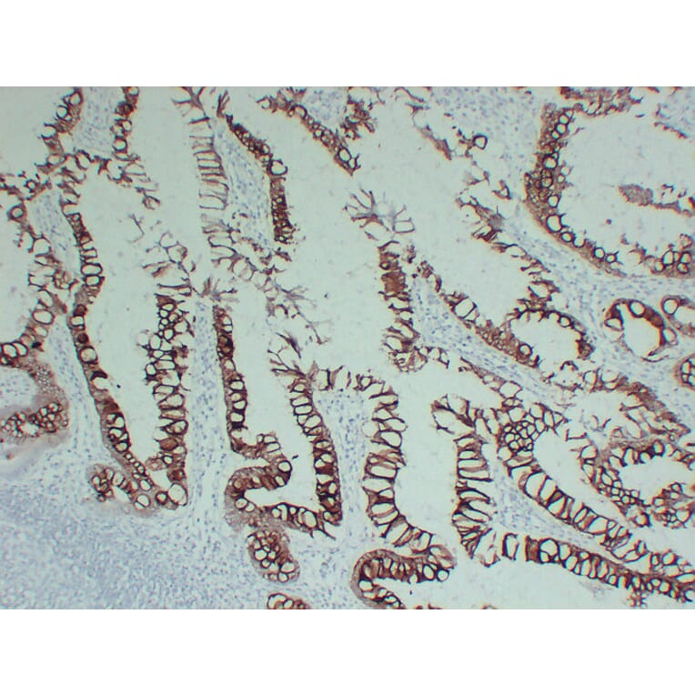 Immunohistochemistry - Anti-Cytokeratin 20 Antibody (V0052) - Antibodies.com