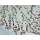 Immunohistochemistry - Anti-Cytokeratin 20 Antibody (V0052) - Antibodies.com