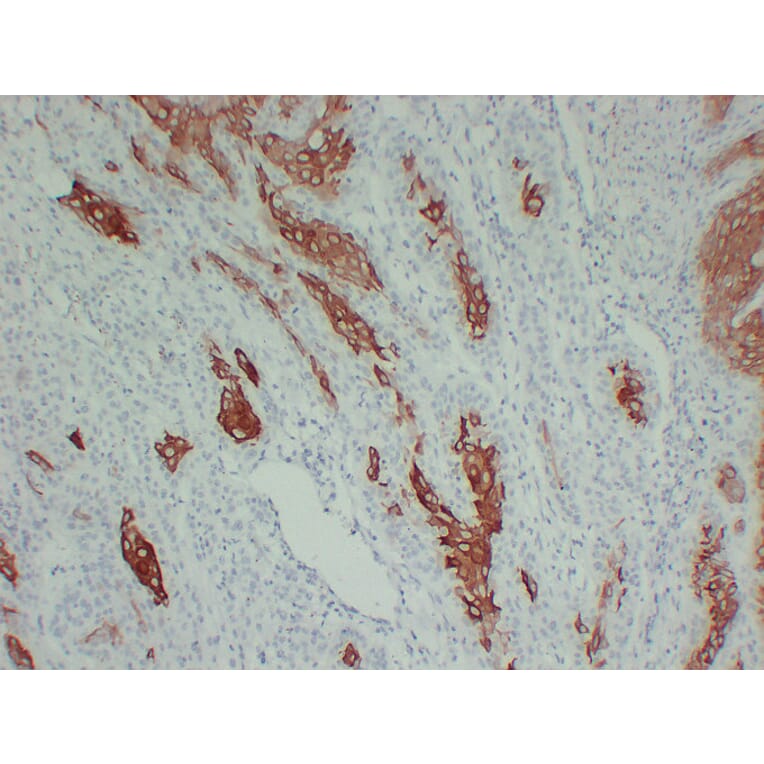 Immunohistochemistry - Anti-Cytokeratin 16 Antibody (V0048) - Antibodies.com