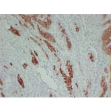 Immunohistochemistry - Anti-Cytokeratin 16 Antibody (V0048) - Antibodies.com