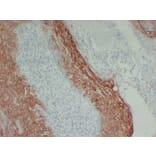 Immunohistochemistry - Anti-Cytokeratin 16 Antibody (V0048) - Antibodies.com