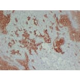 Immunohistochemistry - Anti-Cytokeratin 16 Antibody (V0048) - Antibodies.com