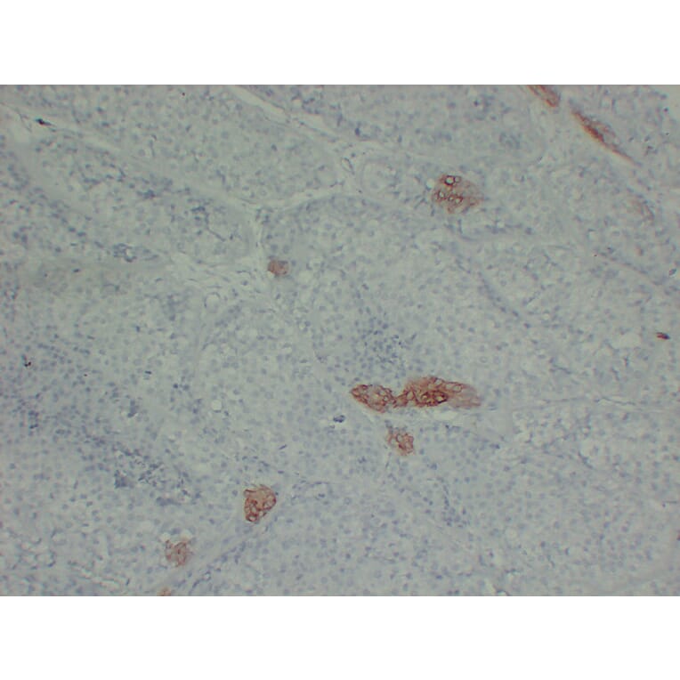 Immunohistochemistry - Anti-Cytokeratin 16 Antibody (V0048) - Antibodies.com