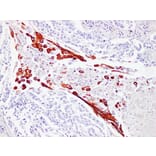 Immunohistochemistry - Anti-Cytokeratin 16 Antibody (V0048) - Antibodies.com