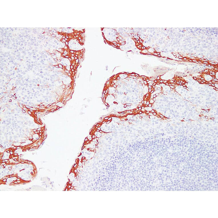 Immunohistochemistry - Anti-Cytokeratin 16 Antibody (V0048) - Antibodies.com