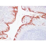 Immunohistochemistry - Anti-Cytokeratin 16 Antibody (V0048) - Antibodies.com