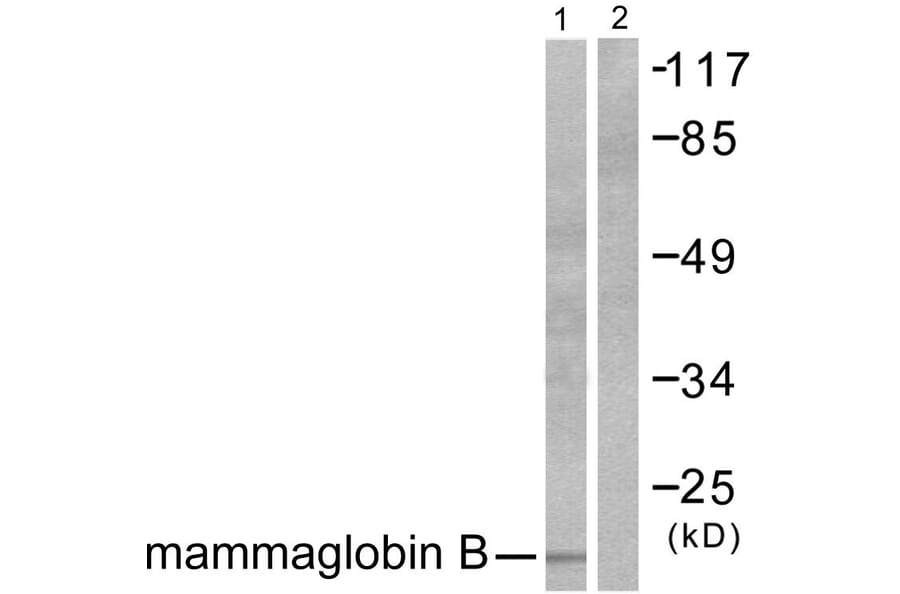 Western Blot - Anti-Mammaglobin B Antibody (C0256) - Antibodies.com