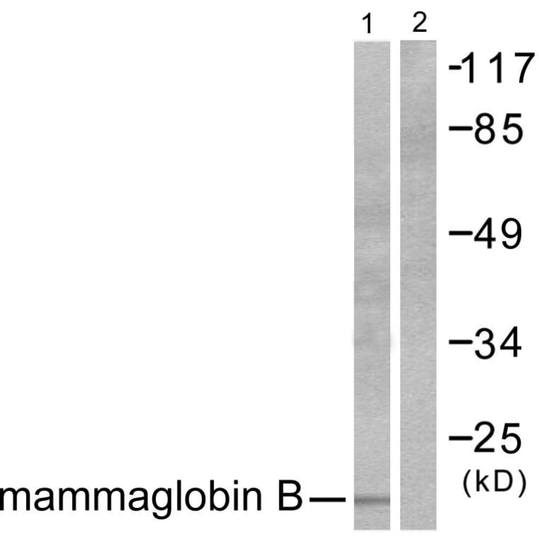 Western Blot - Anti-Mammaglobin B Antibody (C0256) - Antibodies.com