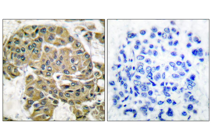 Immunohistochemistry - Anti-Mammaglobin B Antibody (C0256) - Antibodies.com