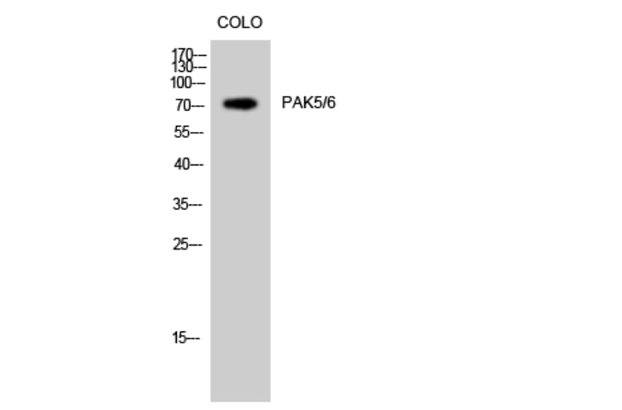 Western Blot - Anti-PAK5 + PAK6 Antibody (B8394) - Antibodies.com