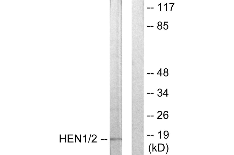 Western Blot - Anti-HEN1 + HEN2 Antibody (C10854) - Antibodies.com