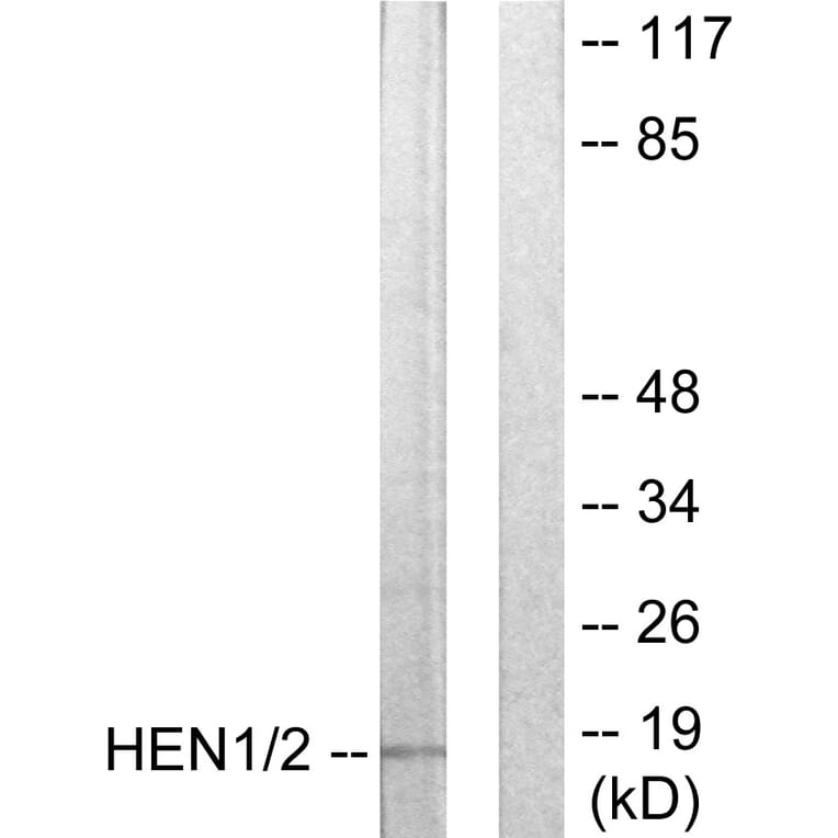 Western Blot - Anti-HEN1 + HEN2 Antibody (C10854) - Antibodies.com