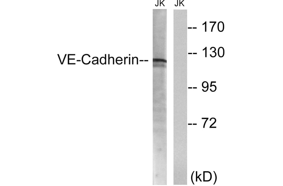 Western Blot - Anti-VE-Cadherin Antibody (B8251) - Antibodies.com