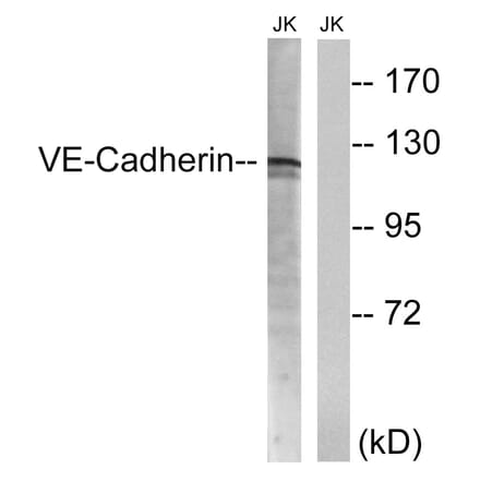 Western Blot - Anti-VE-Cadherin Antibody (B8251) - Antibodies.com