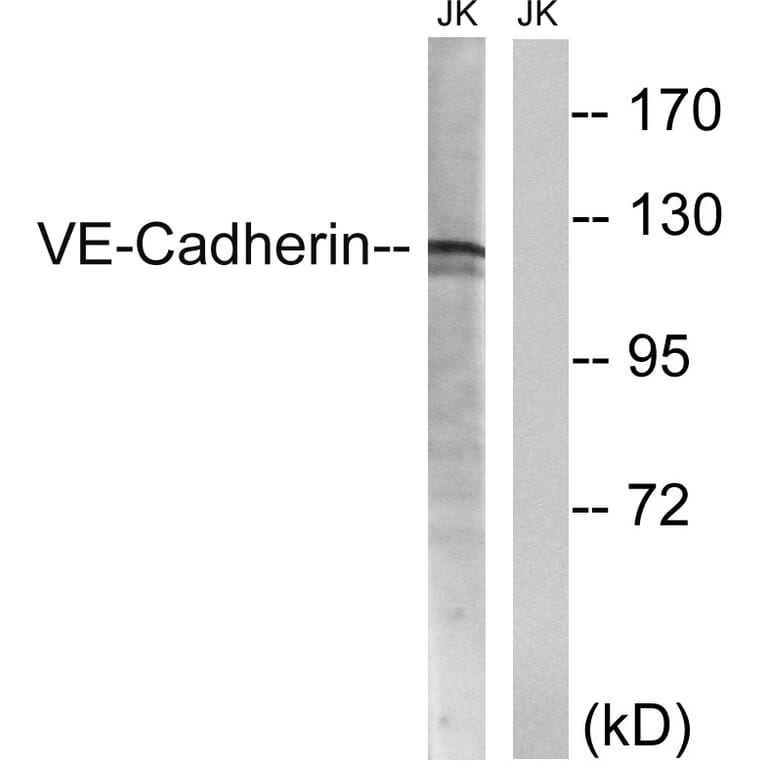 Western Blot - Anti-VE-Cadherin Antibody (B8251) - Antibodies.com