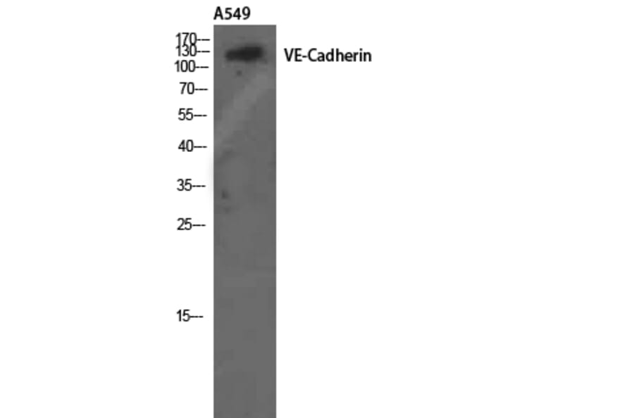 Western Blot - Anti-VE-Cadherin Antibody (B8251) - Antibodies.com