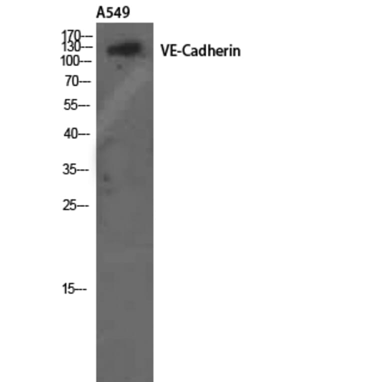 Western Blot - Anti-VE-Cadherin Antibody (B8251) - Antibodies.com