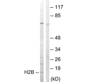 Western Blot - Anti-Histone H2B Antibody (B0791) - Antibodies.com