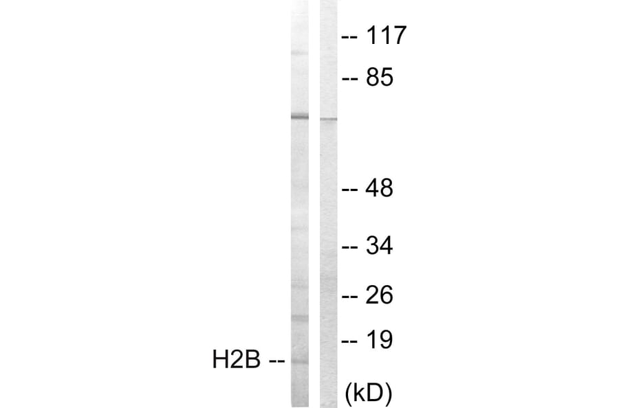 Western Blot - Anti-Histone H2B Antibody (B0791) - Antibodies.com
