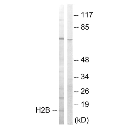 Western Blot - Anti-Histone H2B Antibody (B0791) - Antibodies.com