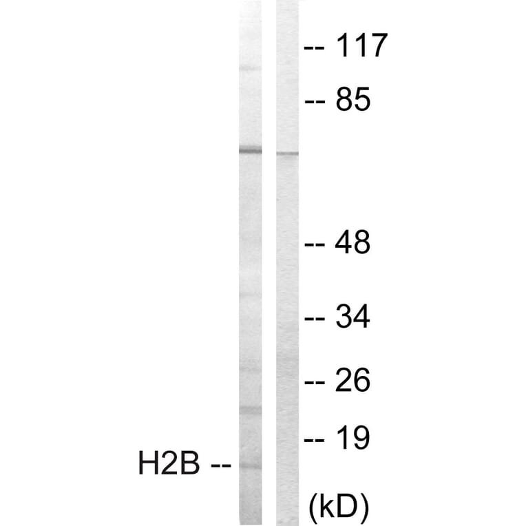 Western Blot - Anti-Histone H2B Antibody (B0791) - Antibodies.com