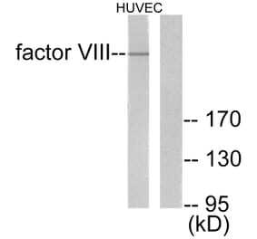 Western Blot - Anti-Factor VIII Antibody (C0187) - Antibodies.com