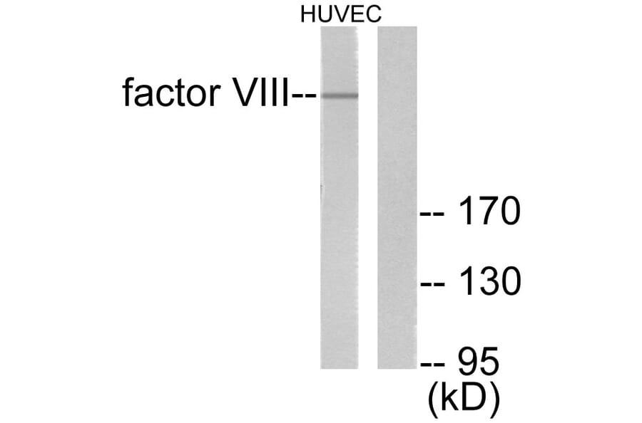 Western Blot - Anti-Factor VIII Antibody (C0187) - Antibodies.com