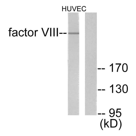 Western Blot - Anti-Factor VIII Antibody (C0187) - Antibodies.com