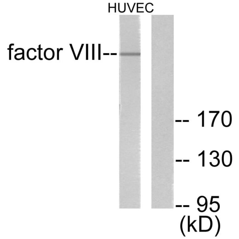 Western Blot - Anti-Factor VIII Antibody (C0187) - Antibodies.com