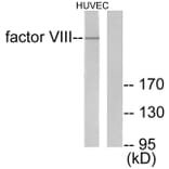 Western Blot - Anti-Factor VIII Antibody (C0187) - Antibodies.com