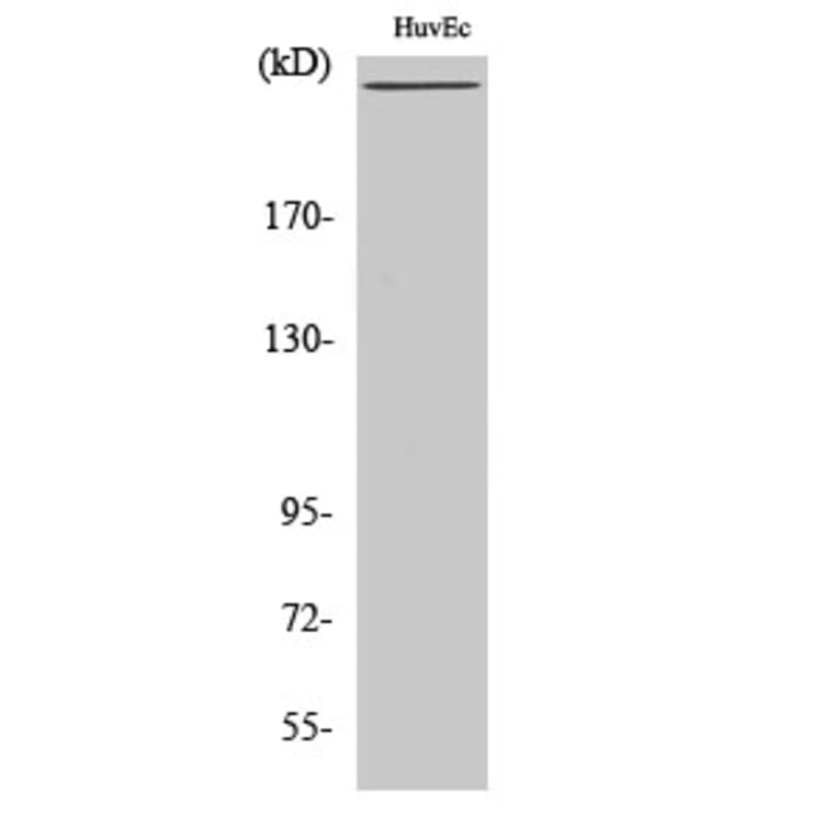 Western Blot - Anti-Factor VIII Antibody (C0187) - Antibodies.com