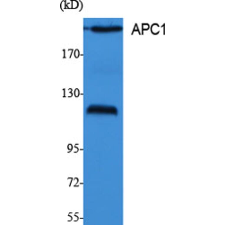 Western Blot - Anti-Cyclosome 1 Antibody (C12817) - Antibodies.com