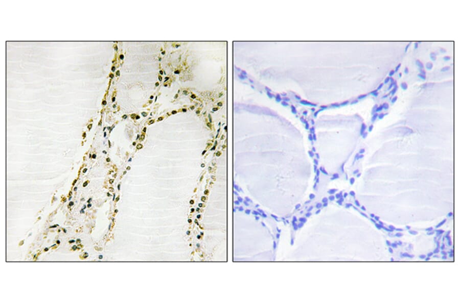 Immunohistochemistry - Anti-S6K-alpha2 Antibody (C11074) - Antibodies.com