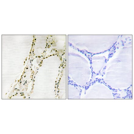 Immunohistochemistry - Anti-S6K-alpha2 Antibody (C11074) - Antibodies.com