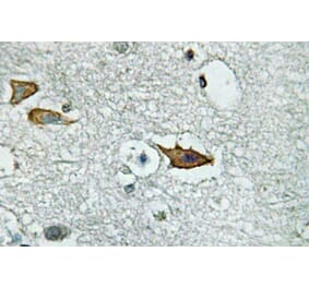 Immunohistochemistry - Anti-IL-5Ralpha Antibody (R12-2213) - Antibodies.com