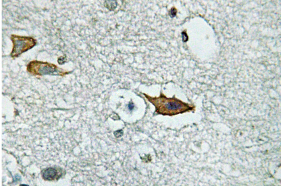 Immunohistochemistry - Anti-IL-5Ralpha Antibody (R12-2213) - Antibodies.com
